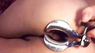 Webcam girl dildo and speculum in asshole by M.D.F